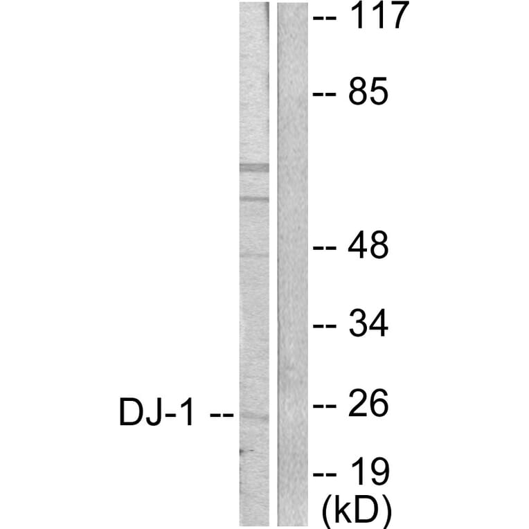 Western Blot - Anti-DJ-1 Antibody (C0172) - Antibodies.com