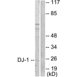 Western Blot - Anti-DJ-1 Antibody (C0172) - Antibodies.com