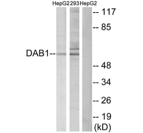 Western Blot - Anti-Dab1 Antibody (B7055) - Antibodies.com