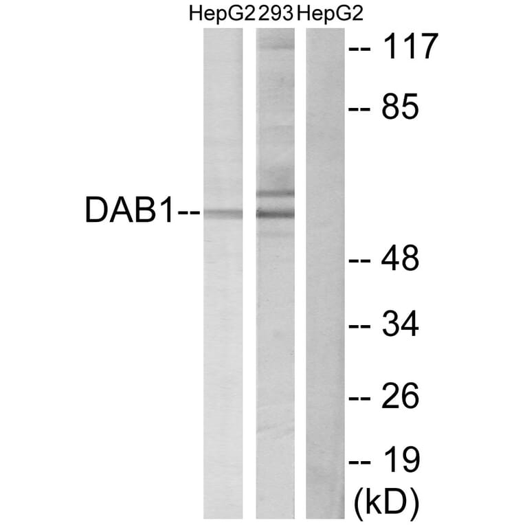 Western Blot - Anti-Dab1 Antibody (B7055) - Antibodies.com