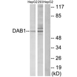 Western Blot - Anti-Dab1 Antibody (B7055) - Antibodies.com