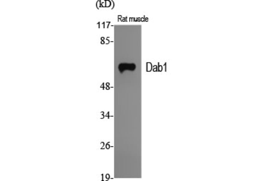 Western Blot - Anti-Dab1 Antibody (B7055) - Antibodies.com