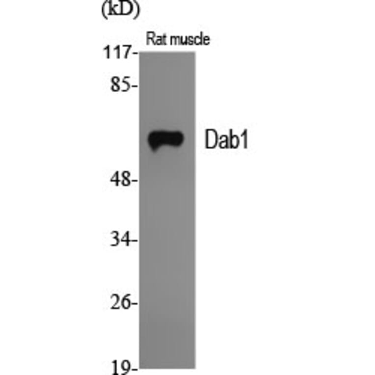 Western Blot - Anti-Dab1 Antibody (B7055) - Antibodies.com