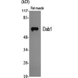 Western Blot - Anti-Dab1 Antibody (B7055) - Antibodies.com