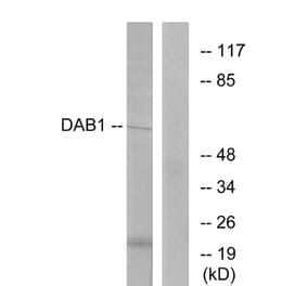 Western Blot - Anti-Dab1 Antibody (B7054) - Antibodies.com