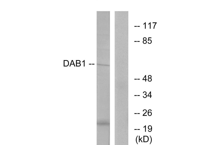 Western Blot - Anti-Dab1 Antibody (B7054) - Antibodies.com