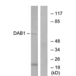 Western Blot - Anti-Dab1 Antibody (B7054) - Antibodies.com