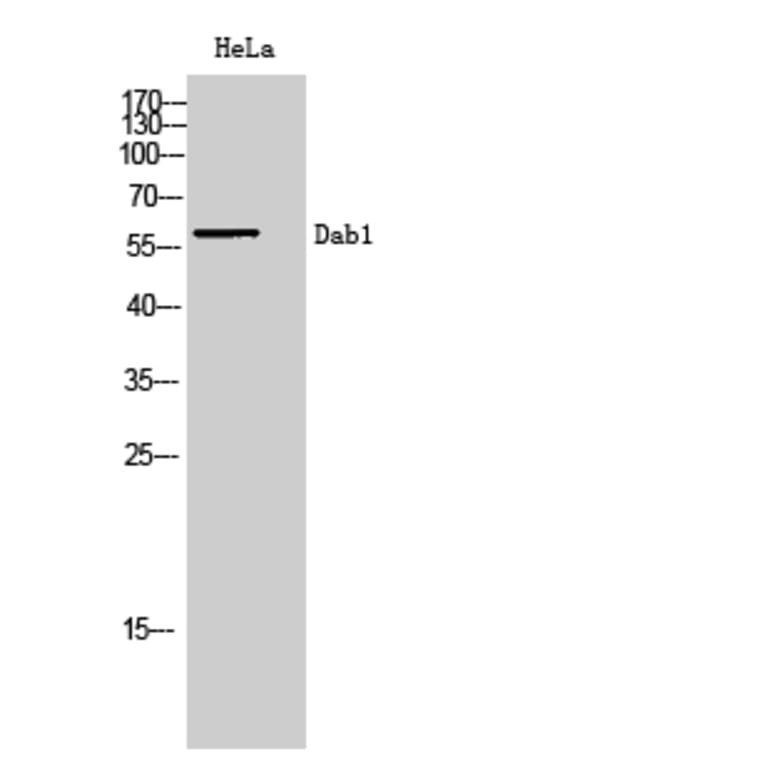 Western Blot - Anti-Dab1 Antibody (B7054) - Antibodies.com