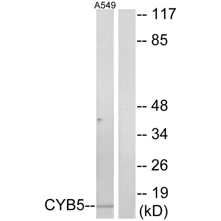 Western Blot - Anti-CYB5 Antibody (C13038) - Antibodies.com