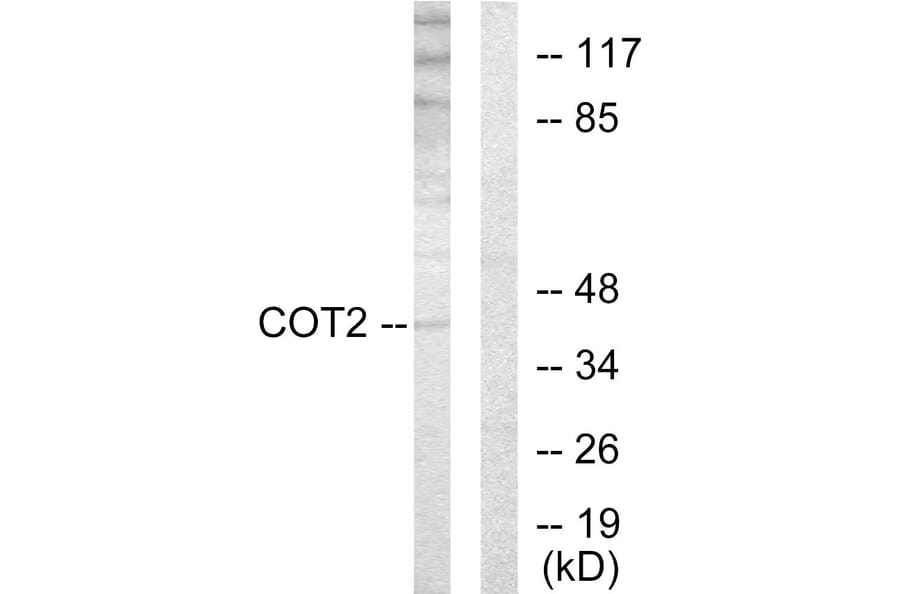 Western Blot - Anti-COT2 Antibody (C10471) - Antibodies.com