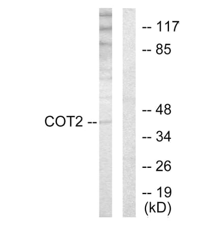 Western Blot - Anti-COT2 Antibody (C10471) - Antibodies.com