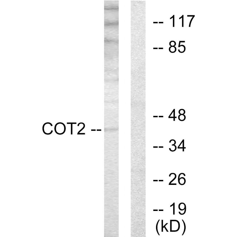 Western Blot - Anti-COT2 Antibody (C10471) - Antibodies.com