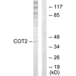 Western Blot - Anti-COT2 Antibody (C10471) - Antibodies.com