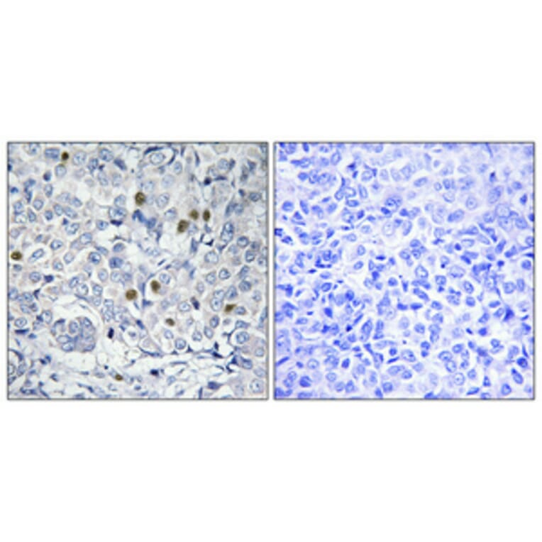 Immunohistochemistry - Anti-COT2 Antibody (C10471) - Antibodies.com