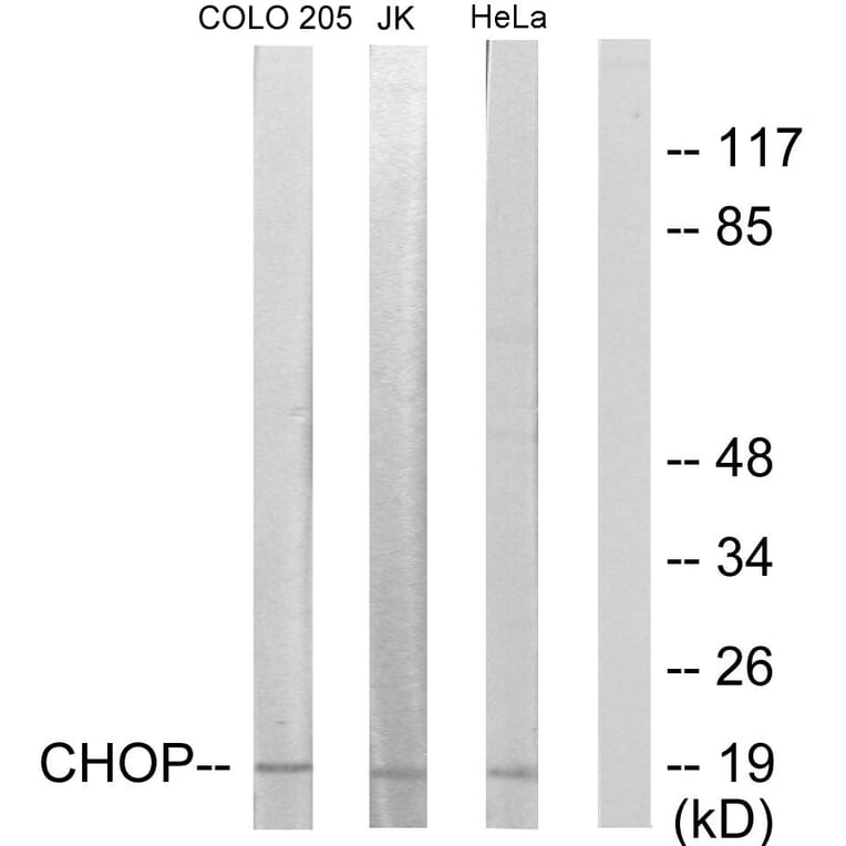 Western Blot - Anti-CHOP Antibody (B0863) - Antibodies.com