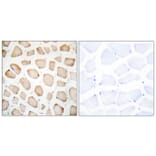 Immunohistochemistry - Anti-CHOP Antibody (B0863) - Antibodies.com