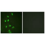 Immunofluorescence - Anti-CHOP Antibody (B0863) - Antibodies.com