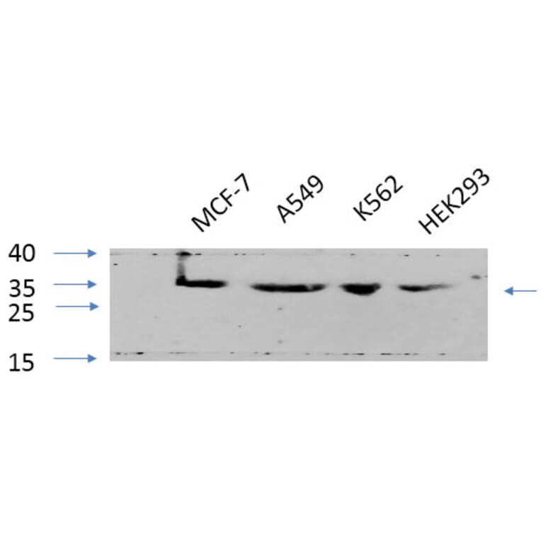 Western Blot - Anti-CDK2 Antibody (C10474) - Antibodies.com