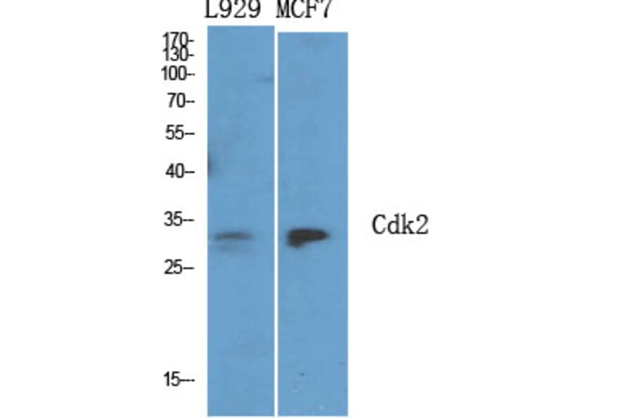 Immunohistochemistry - Anti-CDK2 Antibody (C10474) - Antibodies.com