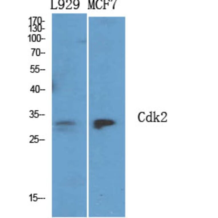 Immunohistochemistry - Anti-CDK2 Antibody (C10474) - Antibodies.com
