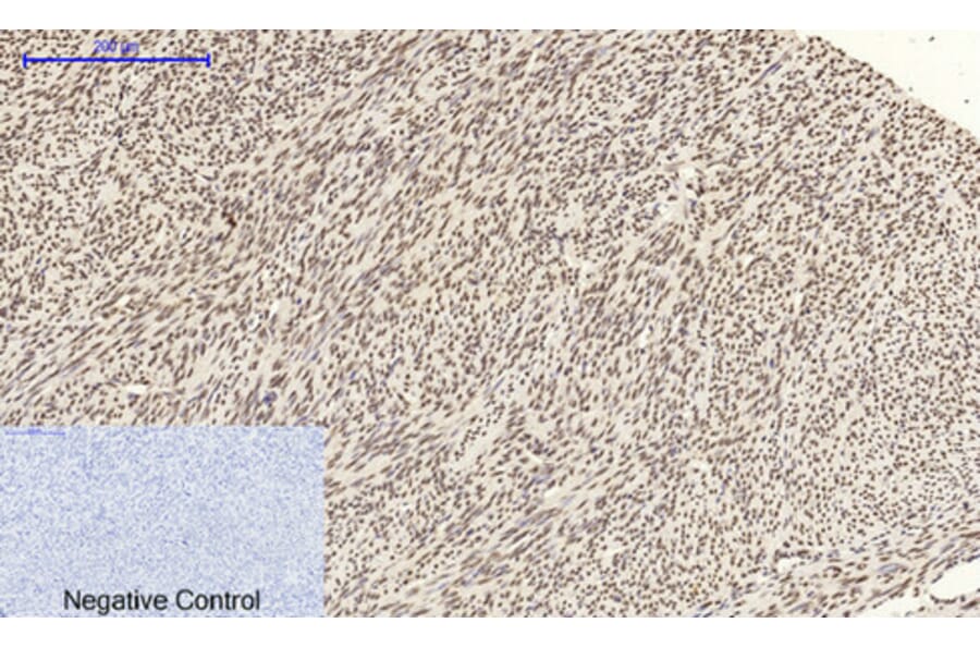 Immunohistochemistry - Anti-CDK2 Antibody (C10474) - Antibodies.com