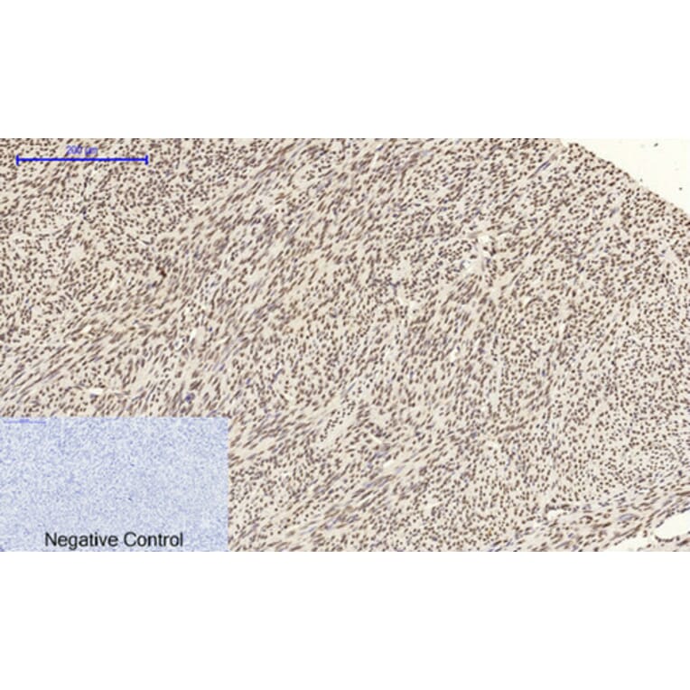 Immunohistochemistry - Anti-CDK2 Antibody (C10474) - Antibodies.com