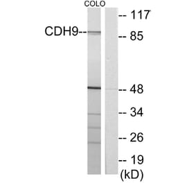 Western Blot - Anti-CDH9 Antibody (C12107) - Antibodies.com