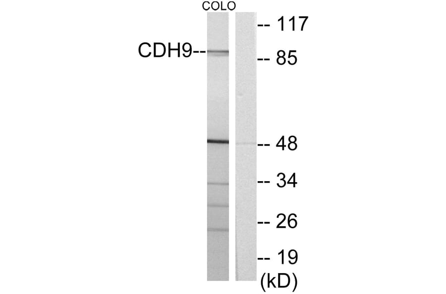 Western Blot - Anti-CDH9 Antibody (C12107) - Antibodies.com