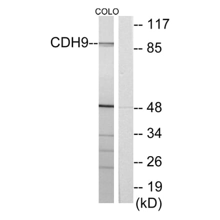 Western Blot - Anti-CDH9 Antibody (C12107) - Antibodies.com