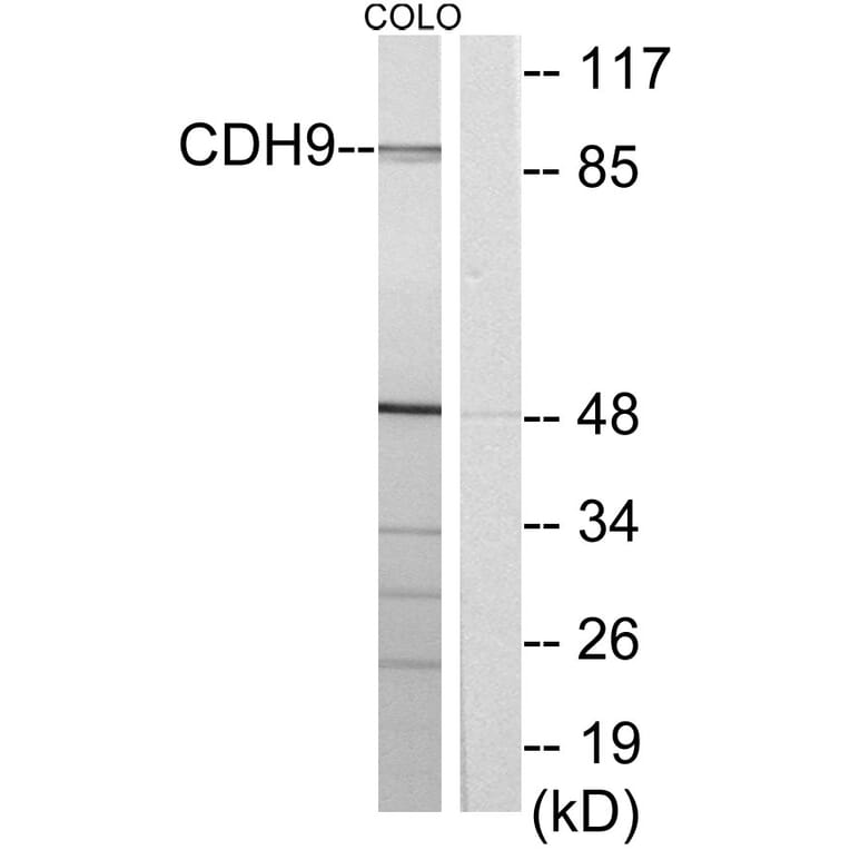 Western Blot - Anti-CDH9 Antibody (C12107) - Antibodies.com