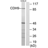 Western Blot - Anti-CDH9 Antibody (C12107) - Antibodies.com
