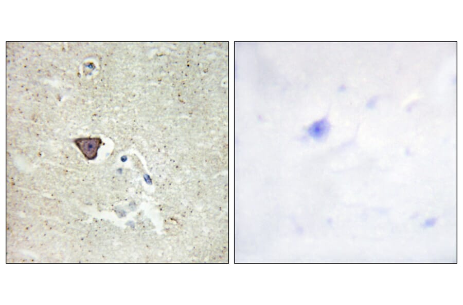 Immunohistochemistry - Anti-CDH9 Antibody (C12107) - Antibodies.com