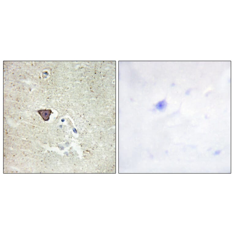 Immunohistochemistry - Anti-CDH9 Antibody (C12107) - Antibodies.com