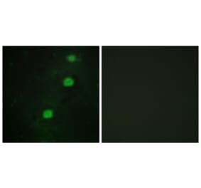 Immunofluorescence - Anti-CCRK Antibody (C11329) - Antibodies.com