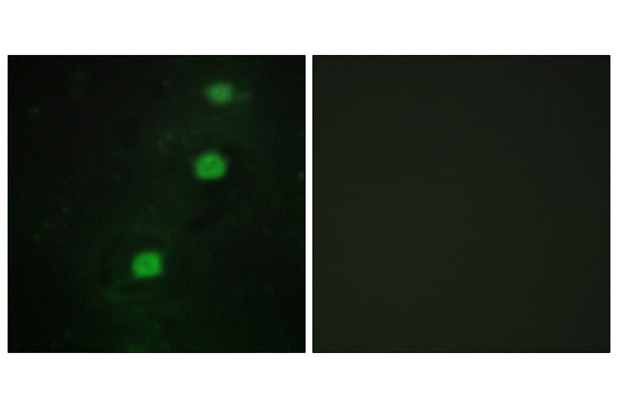 Immunofluorescence - Anti-CCRK Antibody (C11329) - Antibodies.com