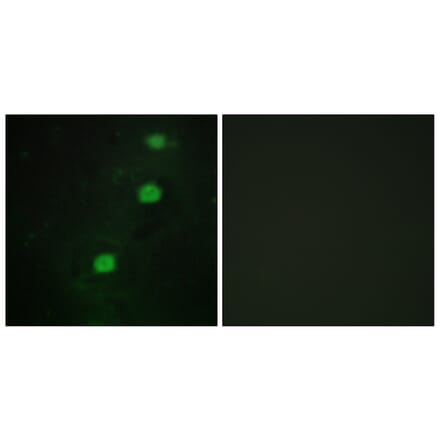 Immunofluorescence - Anti-CCRK Antibody (C11329) - Antibodies.com