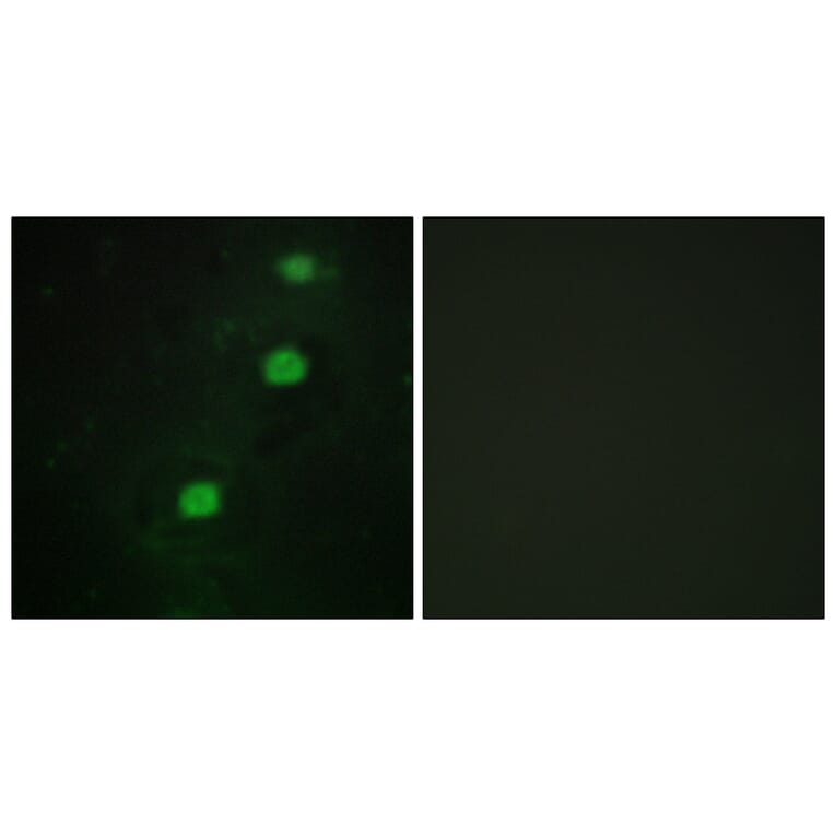 Immunofluorescence - Anti-CCRK Antibody (C11329) - Antibodies.com