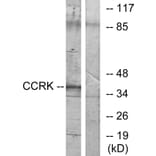 Western Blot - Anti-CCRK Antibody (C11329) - Antibodies.com