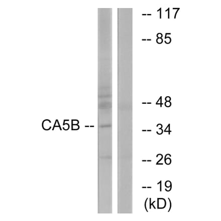 Western Blot - Anti-CA5B Antibody (C14942) - Antibodies.com