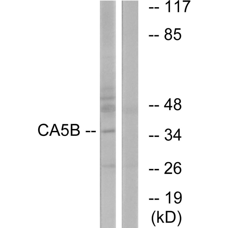 Western Blot - Anti-CA5B Antibody (C14942) - Antibodies.com