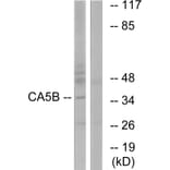 Western Blot - Anti-CA5B Antibody (C14942) - Antibodies.com