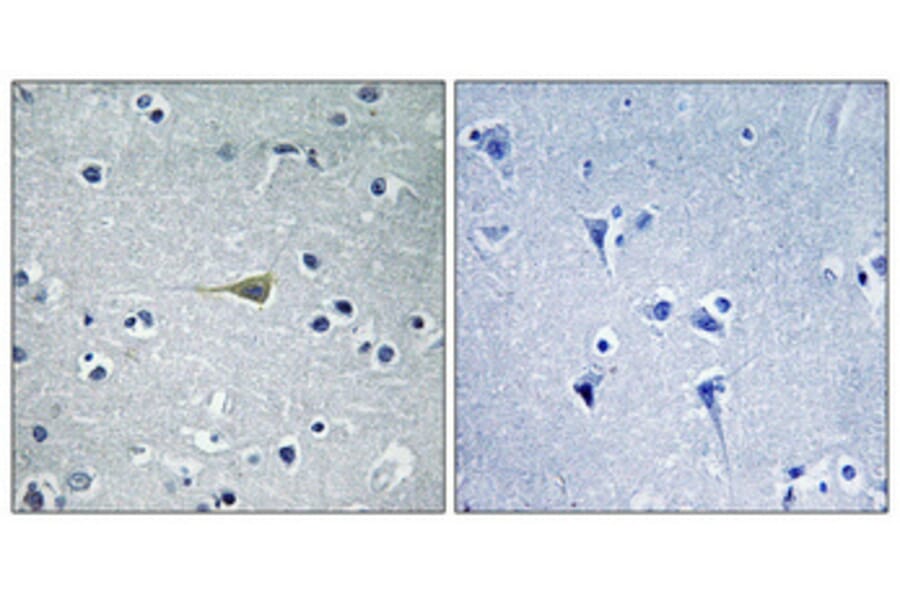 Immunohistochemistry - Anti-CA5B Antibody (C14942) - Antibodies.com