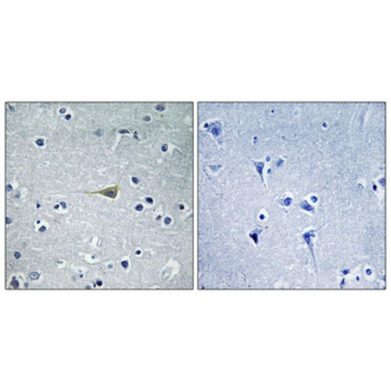 Immunohistochemistry - Anti-CA5B Antibody (C14942) - Antibodies.com