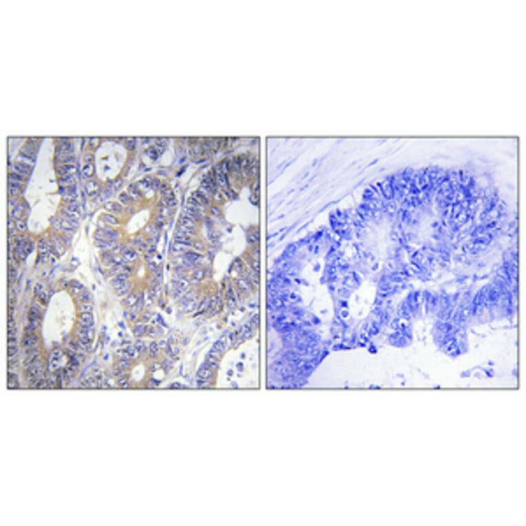 Immunohistochemistry - Anti-BCLW Antibody (C13031) - Antibodies.com