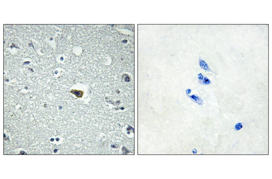 Immunohistochemistry - Anti-BAI1 Antibody (G213) - Antibodies.com