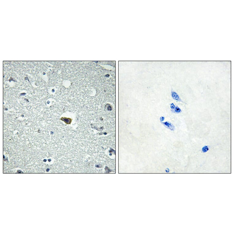 Immunohistochemistry - Anti-BAI1 Antibody (G213) - Antibodies.com