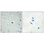 Immunohistochemistry - Anti-BAI1 Antibody (G213) - Antibodies.com