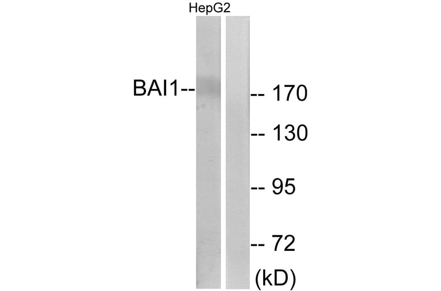 Western Blot - Anti-BAI1 Antibody (G213) - Antibodies.com