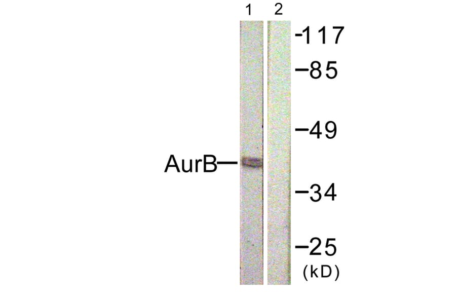 Western Blot - Anti-AurB Antibody (B1021) - Antibodies.com
