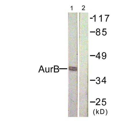 Western Blot - Anti-AurB Antibody (B1021) - Antibodies.com